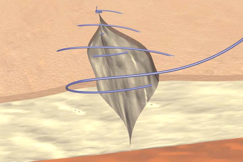 Continuous skin suture