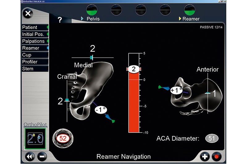 Reamer Navigation