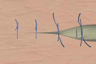 Simple skin suture