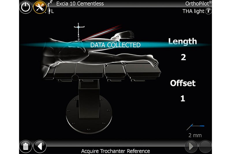 Acquire Trochanter Reference