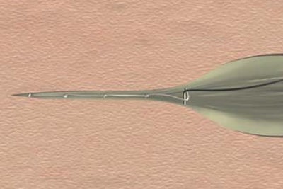 Continuous subcutaneous interlaced suture