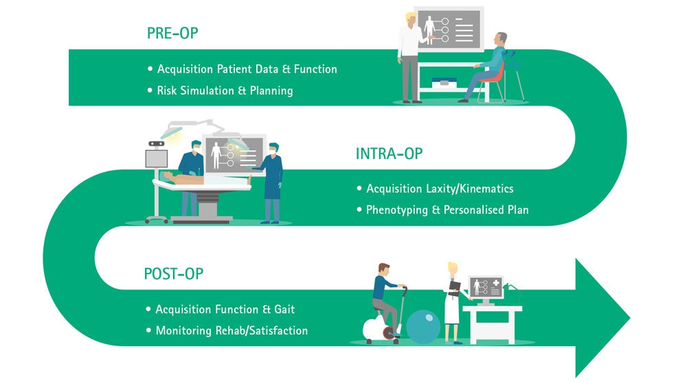A process image in which the pre-op starts with acquisition patient data & function and risk simulation & planning, where a doctor and a patient can be seen receiving information. The process continues with the intra-op and acquisition laxity/kinematics and phenotyping & personalized plan, here a patient can be seen on the operating table next to two doctors. The last phase is the post-op phase with the acquisition function & gait and monitoring rehab/satisfaction, here you can see a patient on a stationary bike and an exercise ball, next to a doctor who is recording it.