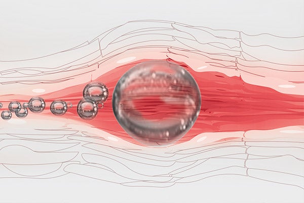 Air bubble in a vein