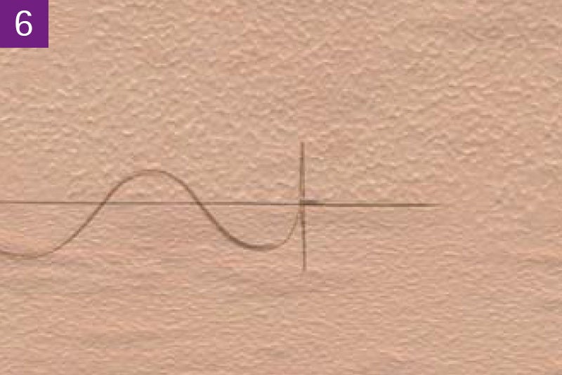 Continuous intracutaneous absorbable suture