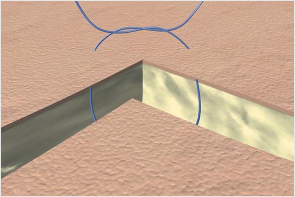 Corner suture