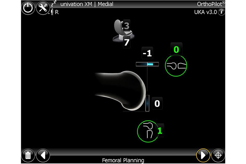 Femoral Planning