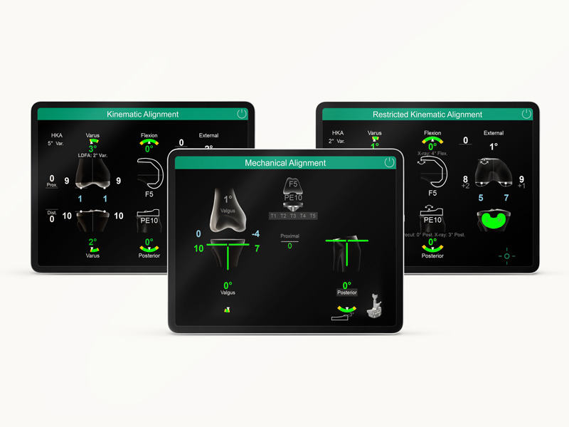 Three different OrthoPilot Elite screens showing the different software types: mechanical alignment, kinematic alignment and restricted kinematic alignment.